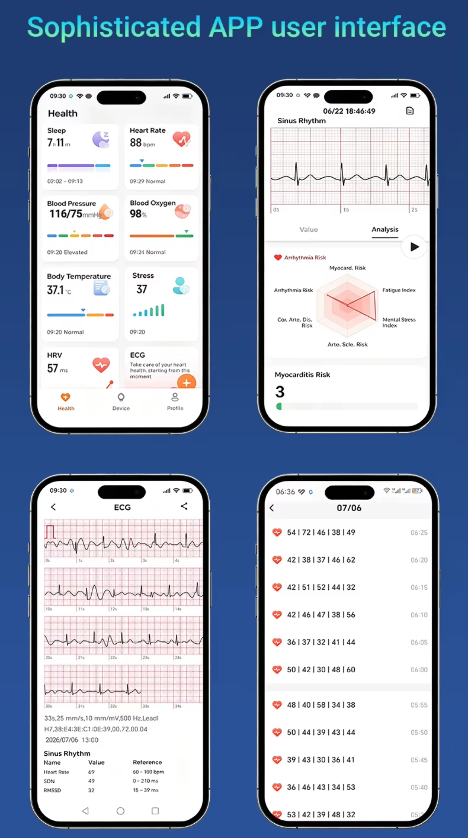 Screenless Smart Bracelets ECG HRV Monitor Fitness Band tracker Without Screen